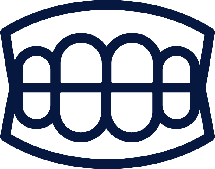 RADIOFREQUENZA